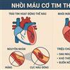Nhồi Máu Cơ Tim Thất Phải: Hiểu Rõ Để Bảo Vệ Trái Tim Bạn